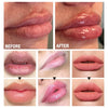 Achieve Plump Lips in Minutes