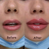 Achieve Plump Lips in Minutes